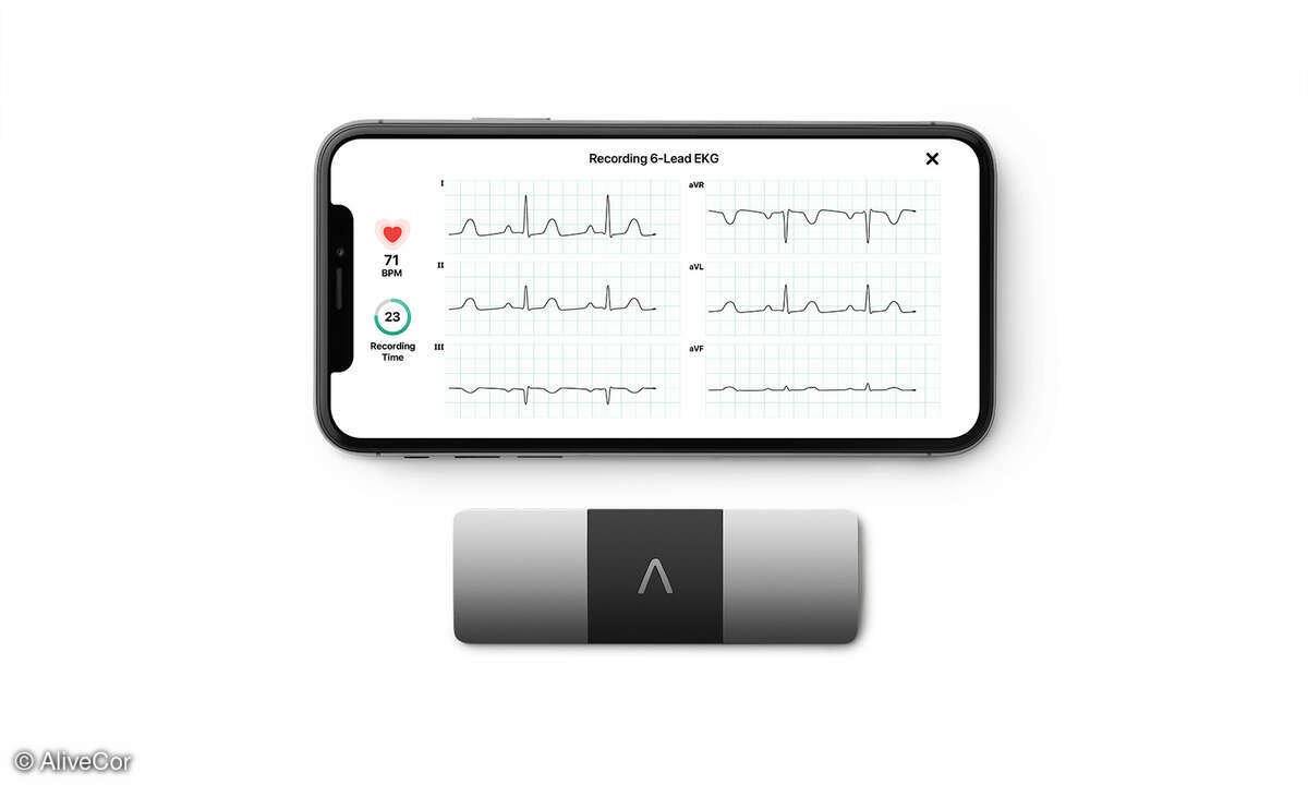 KardiaMobile-EKG